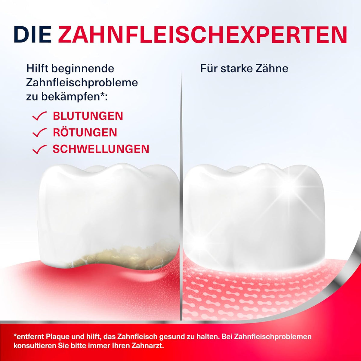 Parodontax Original Toothpaste, 4 x 75 ml Toothpaste, Helps Reduce and Prevent Bleeding Gums — additional product view 4
