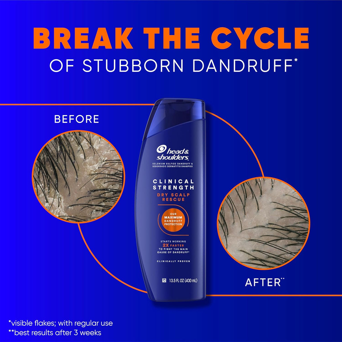 Head & Shoulders Clinical Dandruff Defense + Dry Scalp Rescue Anti-Dandruff Shampoo — 13.5 oz — Twin Pack