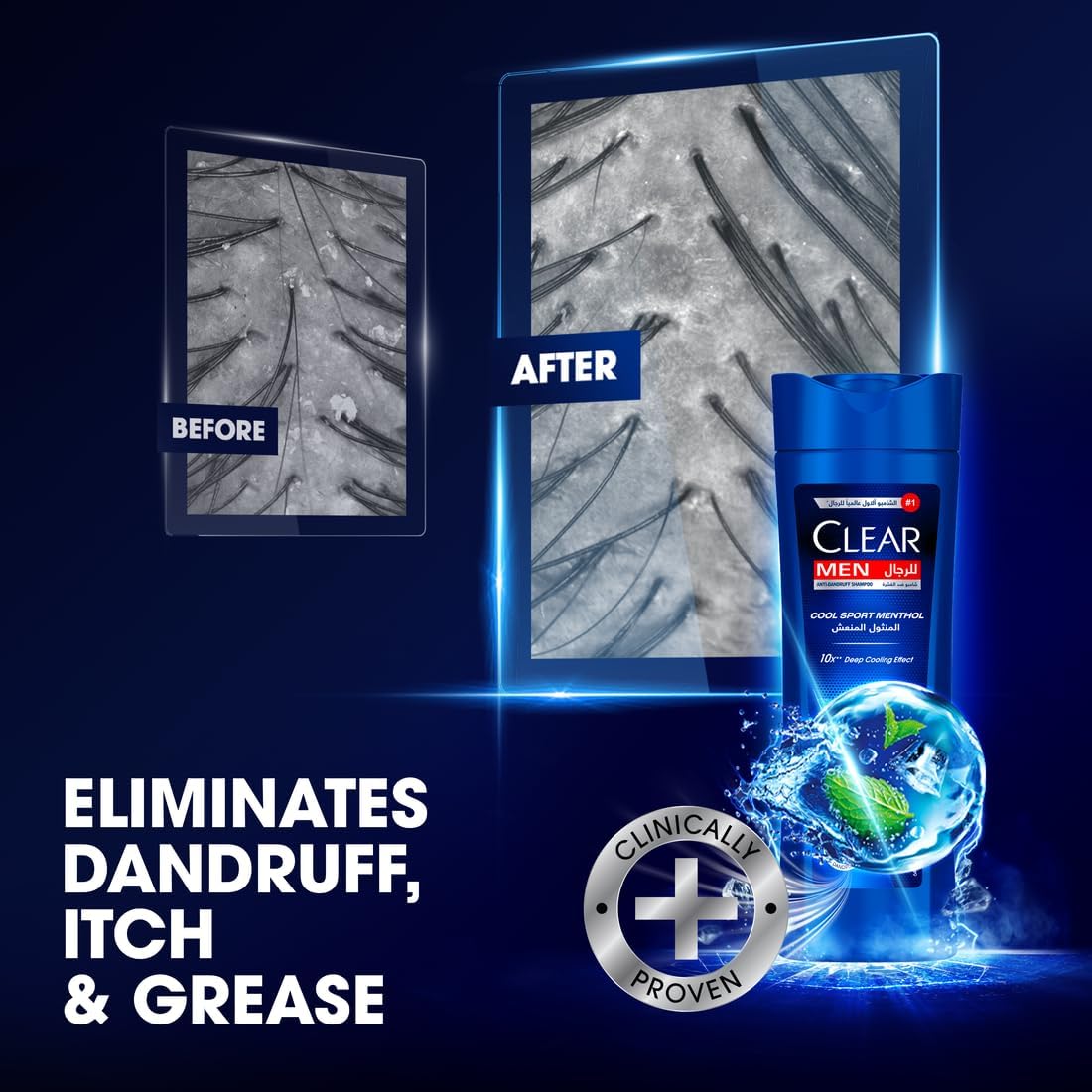 Clear Men Cool Sport Menthol Anti-Dandruff Shampoo — 2 × 350ml
